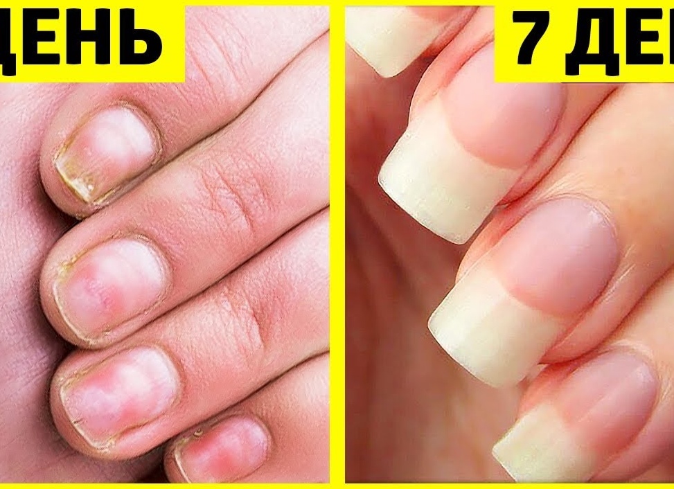 Как быстро укрепить ногти и отрастить их