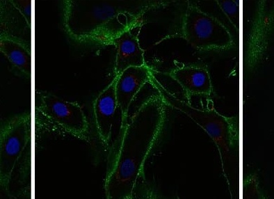 Учёные смогли омолодить клетки кожи на 30 лет