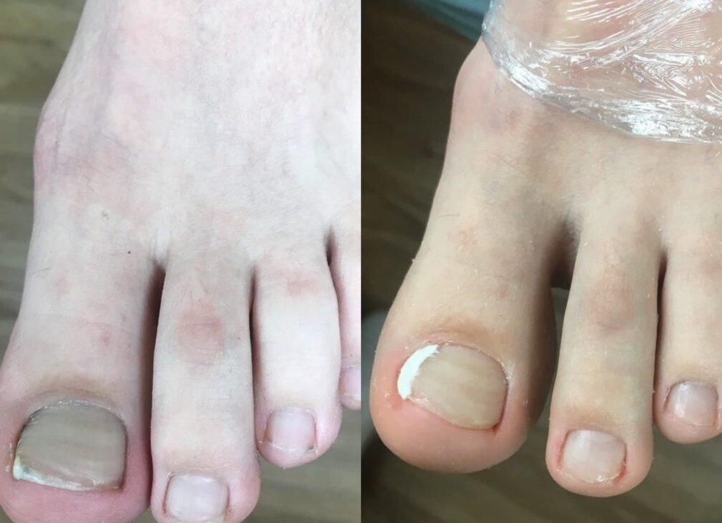 Кто такой подолог и что он лечит