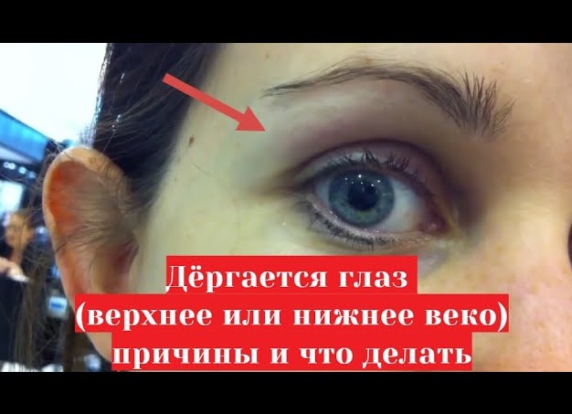 Что делать, если дёргается глаз